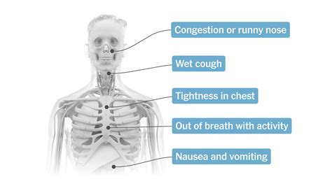 Could My Symptoms Be Covid 19 The New York Times