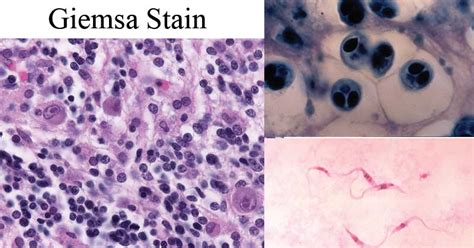 Giemsa Stain Principle Procedure Results Interpretation