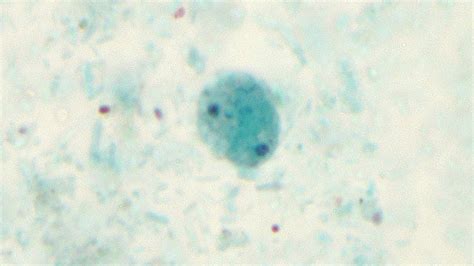 Dientamoeba Fragilis Trichrome