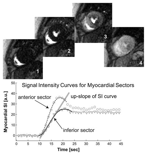 Mr Myocardial Perfusion Imaging Radiology