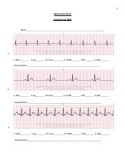 EKG Practice Strips with answers.docx - 1 EKG Practice Sheet Complex ...