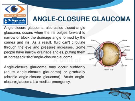 Ppt Glaucoma Glaucoma Surgery Glaucoma Eye Surgery Centre