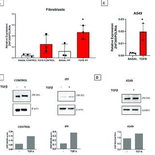 TGFβ 1 induces the overexpression of ZNF365 A ZNF365 expression in