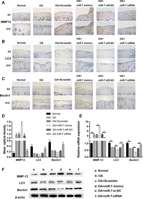 Representative Images Of Immunohistochemical Staining For A Mmp