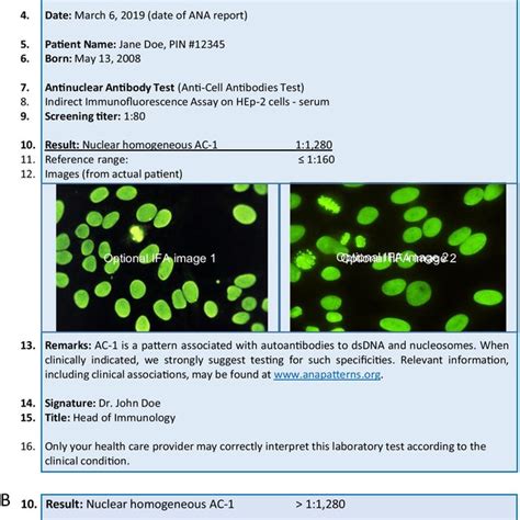 How To Report The Antinuclear Antibodies Anti Cell Antibodies Test On