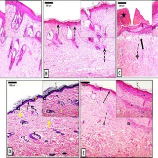 Photomicrographs Of H E Stained Skin Sections Of A Group I Has Normal