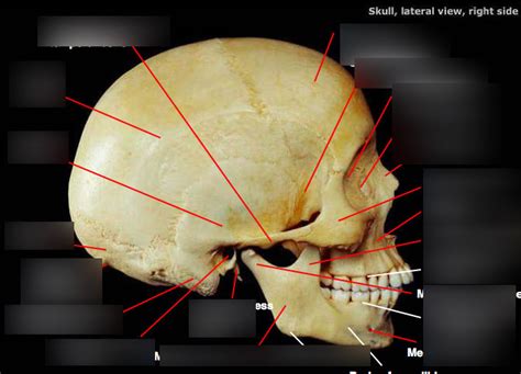 skull, lateral view, rt side (left label) Diagram | Quizlet