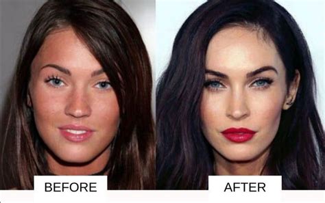 10 Famous Celebrities Who Have had Plastic Surgery | This is Italy | Page 2