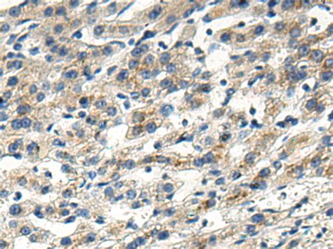 Map Lc A Anti Map Lc A Mouse Monoclonal Antibody