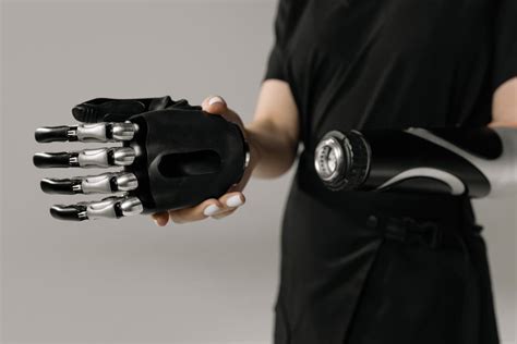 Person with Prosthetic Hand · Free Stock Photo