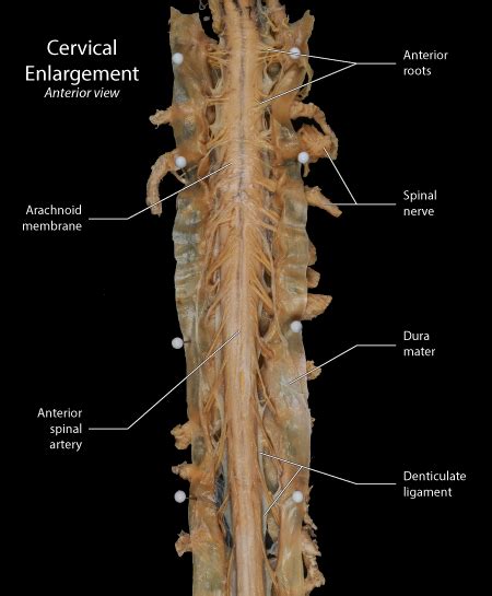 Lumbar Enlargement Cadaver