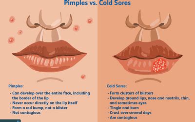 Difference Between a Pimple and a Boil