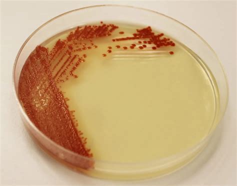 Nutrient Agar Composition Preparation And Uses