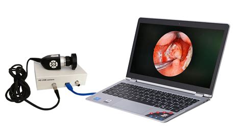 Hd 7021 Medical Portable Camera System Endoscopy Camera With Led Cold Light Source For Hospital