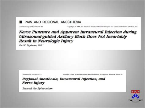 Complications of Regional Anesthesia