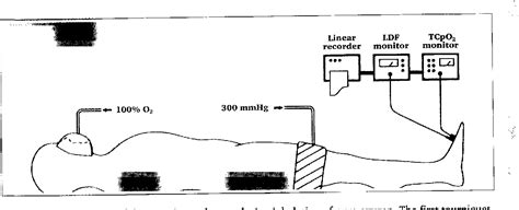 Figure 1 From The Role Of Blood Perfusion And Tissue Oxygenation In The