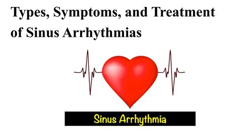 Types, Symptoms, and Treatment of Sinus Arrhythmias by shravanp - Issuu