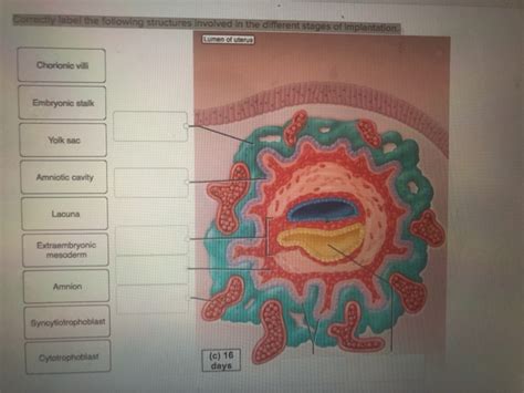 Solved Correctly Label The Following Structures Involved In