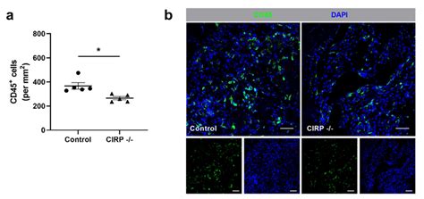 Cold Inducible RNA Binding Protein CIRP Knockout Decreases Leukocyte