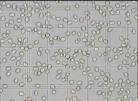 Total Platelet Count Using Neubauer Improved Haemocytometer With Low