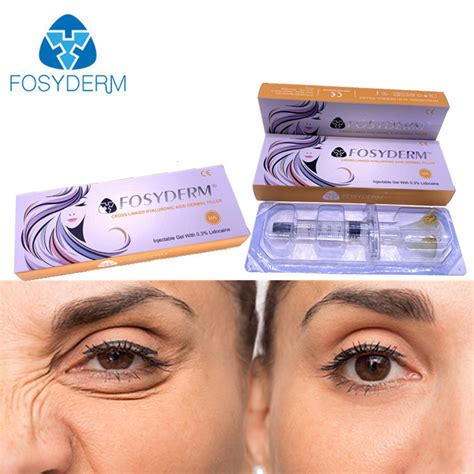 5ml Hyaluronic Acid Fosyderm Dermal Filler Injection For Lips Nose