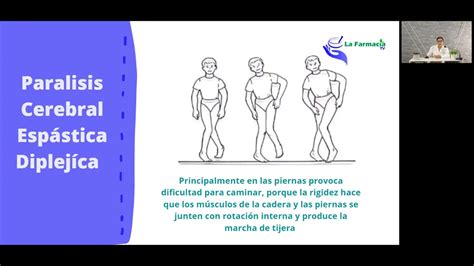 Par Lisis Cerebral Infantil Youtube