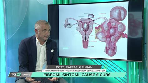 Fibromi Sintomi Cause E Cure Youtube