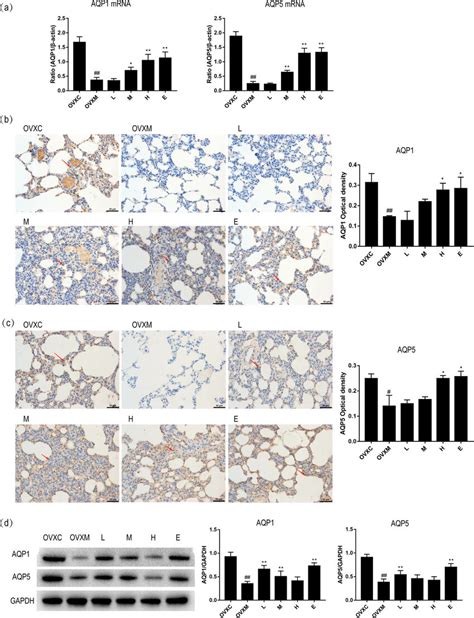 Soy Isoflavone Increases The Mrna And Protein Of Aqp And Aqp Of Lung