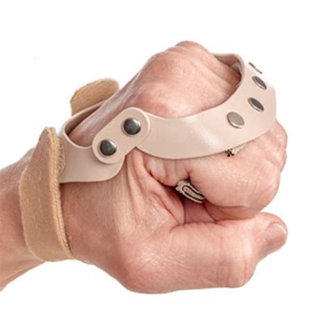 3pp Polycentric Hinged Left Hand Ulnar Deviation Splint Designed By A Hand And Rheumatology