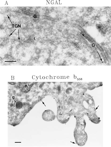 Immunoelectron Microscopy Of Differentiated Transfected Hl 60 Cells