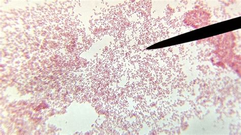 Serratia Marcescens Gram Stain