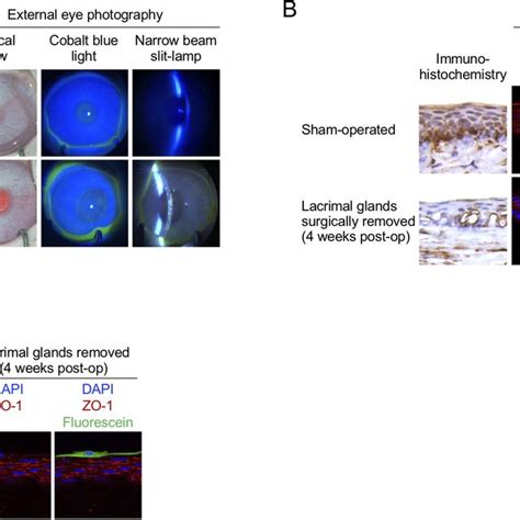 Fluorescein Punctate Staining Are The Fluorescein Incorporated Corneal Download Scientific