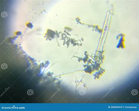 Penicillium Mold Under The Microscope Stock Photography | CartoonDealer.com #203044418