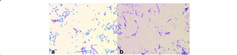 a Gram stain of Nocardia farcinica showing Gram-positive rod-shaped ...