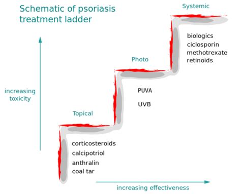 Plaque Psoriasis: Causes, Picture, Symptoms And Treatment