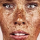 Photos Of People With Freckles POPSUGAR Beauty Photo 3