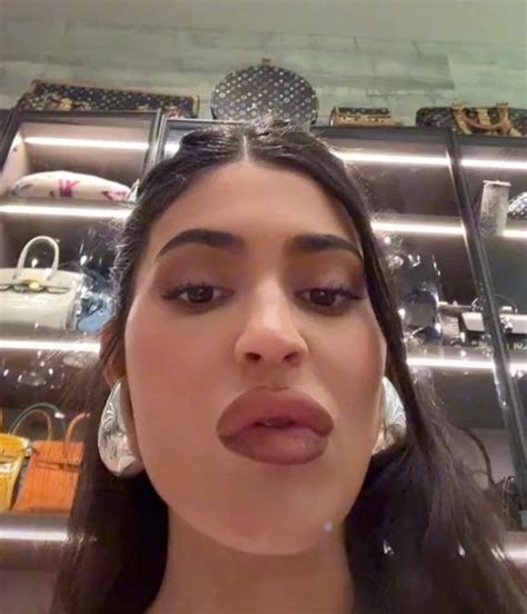 Kardashian fans think Kylie Jenner has 'dissolved' her lip fillers ...