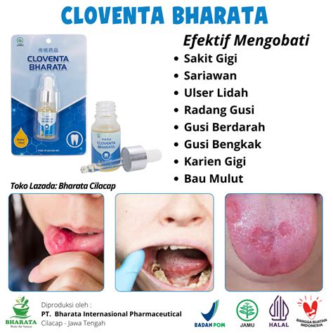 Cloventa Bharata Obat Sakit Gigi Ampuh Obat Gusi Bengkak Obat