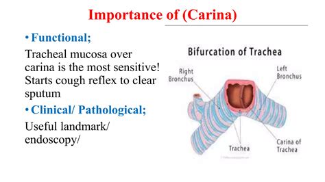 anatomy of trachea.pptx