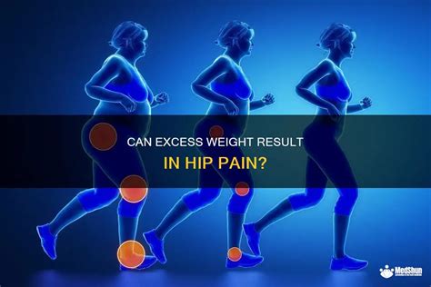 Can Excess Weight Result In Hip Pain Medshun