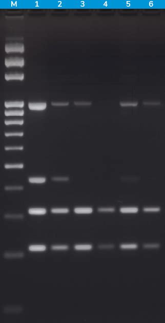 Solis Biodyne Hot Firepol Taq Dna Polymerase Solis Biodyne