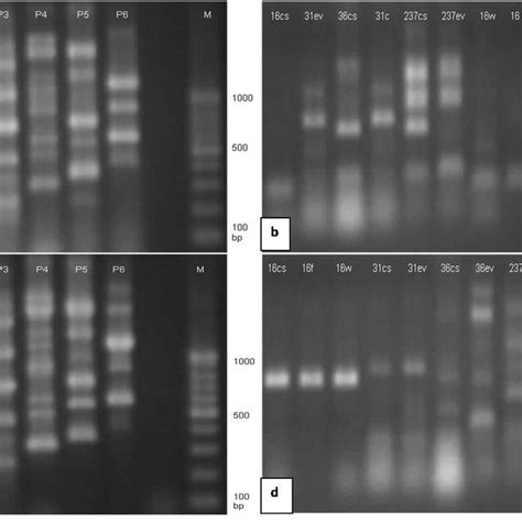 Rapd Patterns Of Clinical And Environmental For The Strains 32 And 45