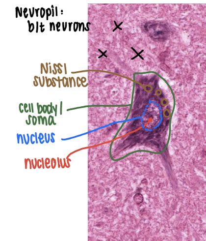 Neuro Path Neurodegenerative Diseases Flashcards Quizlet