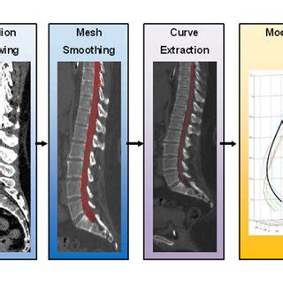 The Spine Curve Assessment Framework Steps The Framework Steps Shown