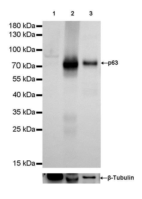 S Rmab® P63 Recombinant Rabbit Mab Sdt 054 38q9h3d4starter Bio