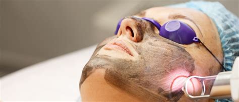 Carbon Facial Skintec