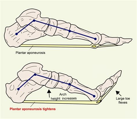 Sports Injury Bulletin Anatomy Plantar Fascia Ruptures