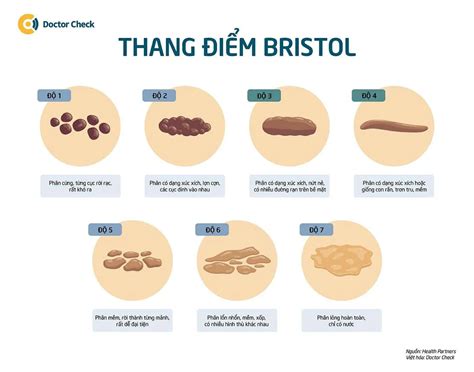 Hội chứng ruột kích thích: Nguyên nhân, triệu chứng và điều trị