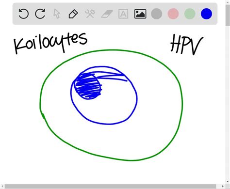 SOLVED:Koilocytes are characteristic of a. cells infected with human papillomavirus b. cells ...