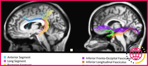 L ambidextérité affecte t elle le cerveau lizengo fr 2024